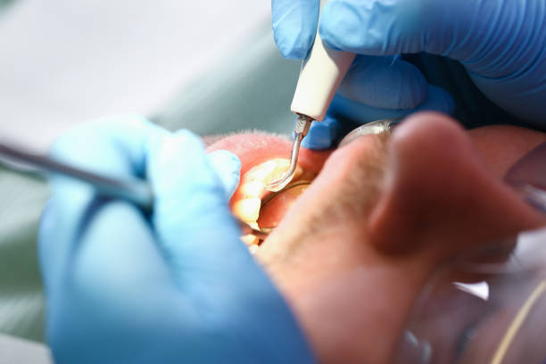 Best Pediatric Emergency Dentist in Delhi, LA