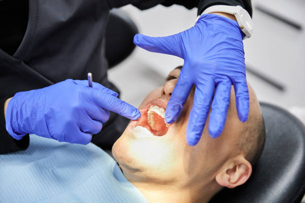 Best Emergency Tooth Extraction in Delhi, LA