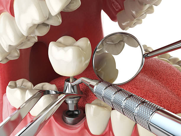 Best Emergency Orthodontic Repairs in Delhi, LA