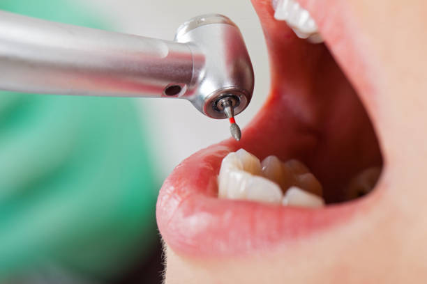 Best Urgent Dental Care in Delhi, LA